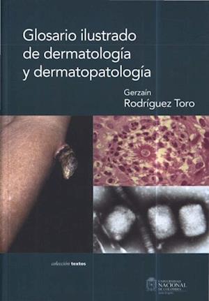 Glosario ilustrado de dermatología y dermatopatología