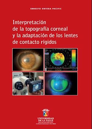 Interpretación de la topografía corneal y la adaptación de los lentes de contacto rígidos