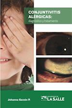 Conjuntivitis alérgicas