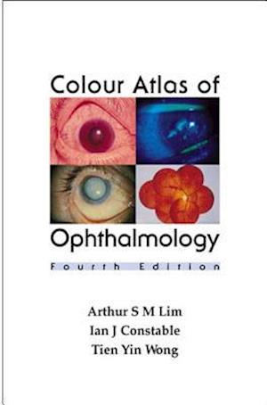 Colour Atlas Of Ophthalmology (Fourth Edition)