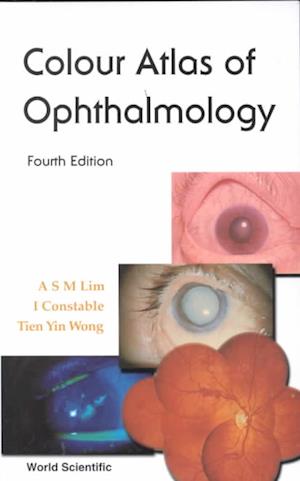 Colour Atlas Of Ophthalmology (Fourth Edition)