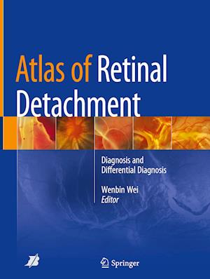 Atlas of Retinal Detachment