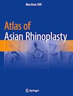Atlas of Asian Rhinoplasty