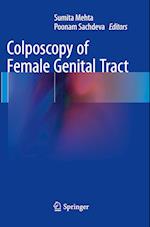 Colposcopy of Female Genital Tract