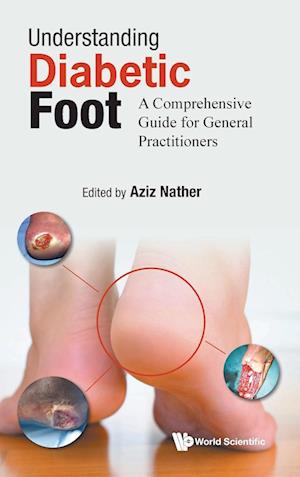 Understanding Diabetic Foot: A Comprehensive Guide For General Practitioners