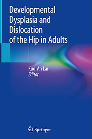 Developmental Dysplasia and Dislocation of the Hip in Adults