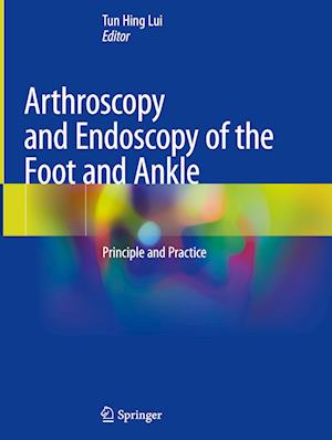 Arthroscopy and Endoscopy of the Foot and Ankle