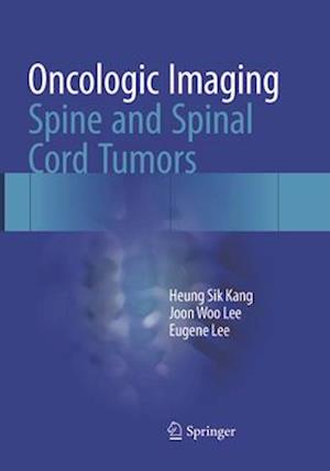 Oncologic Imaging: Spine and Spinal Cord Tumors