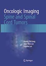 Oncologic Imaging: Spine and Spinal Cord Tumors