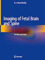 Imaging of Fetal Brain and Spine