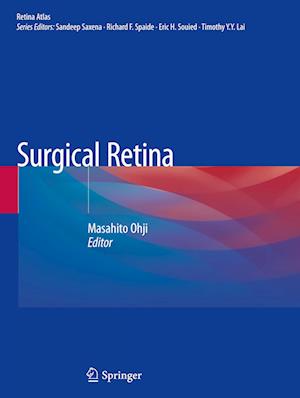 Surgical Retina