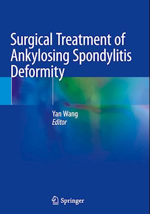 Surgical Treatment of Ankylosing Spondylitis Deformity