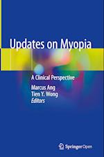 Updates on Myopia