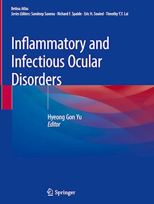 Inflammatory and Infectious Ocular Disorders