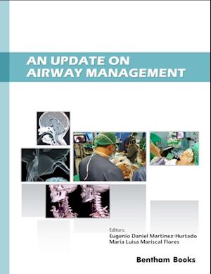 An Update on Airway Management