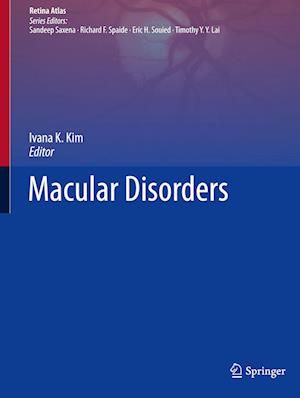 Macular Disorders