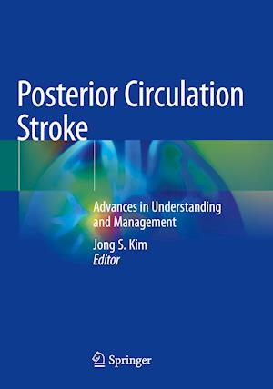 Posterior Circulation Stroke