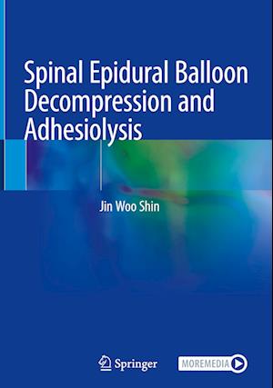 Spinal Epidural Balloon Decompression and Adhesiolysis