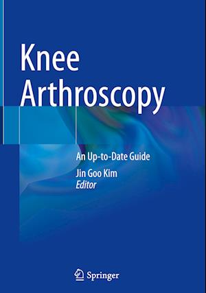 Knee Arthroscopy