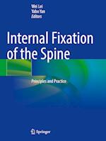 Internal Fixation of the Spine