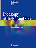 Endoscopy of the Hip and Knee