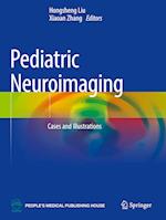 Pediatric Neuroimaging