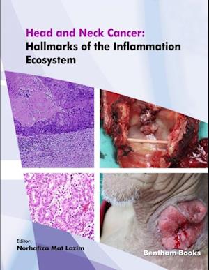 Head and Neck Cancer: Hallmarks of the Inflammation Ecosystem