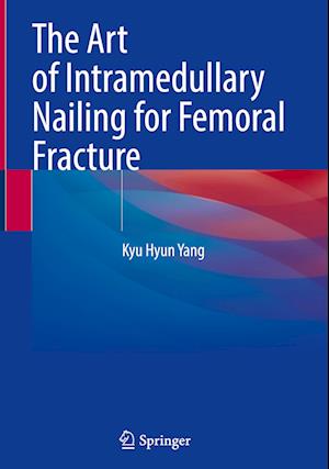 The Art of Intramedullary Nailing for Femoral Fracture