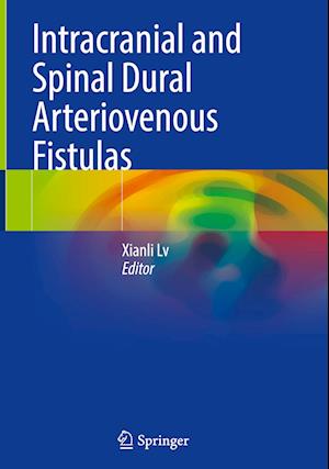 Intracranial and Spinal Dural Arteriovenous Fistulas