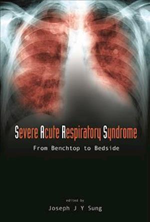 Severe Acute Respiratory Syndrome (Sars): From Benchtop To Bedside