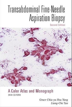 Transabdominal Fine-needle Aspiration Biopsy (2nd Edition): A Color Atlas And Monograph (With Cd-rom)