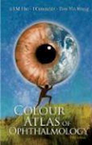 Colour Atlas Of Ophthalmology (Fifth Edition)