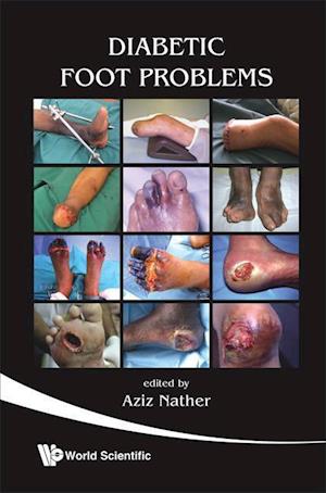 Diabetic Foot Problems