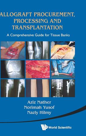 Allograft Procurement, Processing And Transplantation: A Comprehensive Guide For Tissue Banks