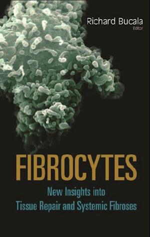 Fibrocytes: New Insights Into Tissue Repair And Systemic Fibroses