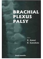 Brachial Plexus Palsy