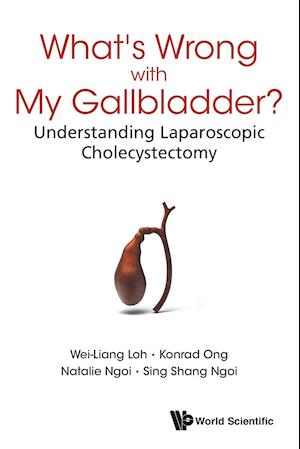 What's Wrong with My Gallbladder?: Understanding Laparoscopic Cholecystectomy