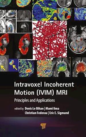 Intravoxel Incoherent Motion (IVIM) MRI