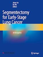 Segmentectomy for Early-Stage Lung Cancer