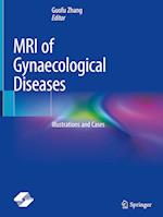 MRI of Gynaecological Diseases