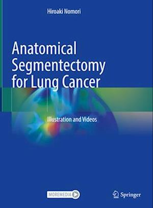 Anatomical Segmentectomy for Lung Cancer