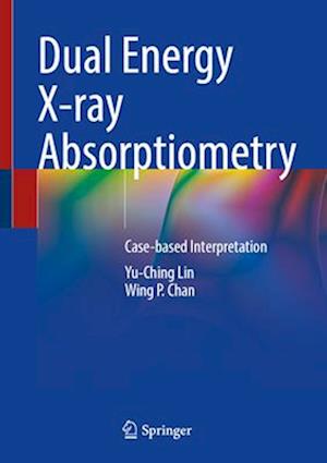 Dual Energy X-Ray Absorptiometry