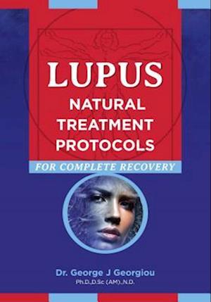 Lupus