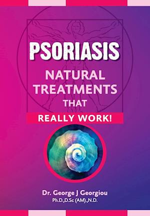 Psoriasis