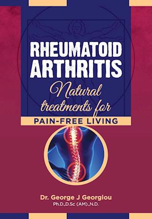 Rheumatoid Arthritis