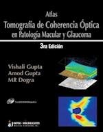 Atlas - Tomografia de Coherencia Optica en Patologia Macular y Glaucoma