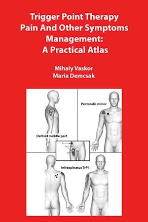 Trigger Point Therapy Pain And Other Symptoms Management: A Practical Atlas