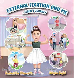 External Fixation and Me