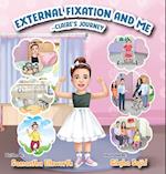 External Fixation and Me 