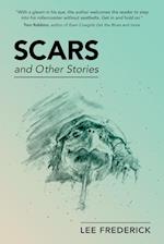 Scars